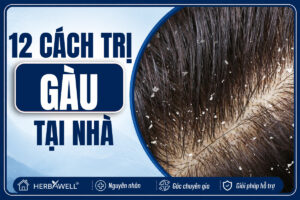 12 cách trị gàu tại nhà