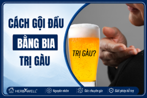 Cách gội đầu bằng bia trị gàu