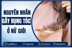 Nguyên nhân rụng tóc ở nữ