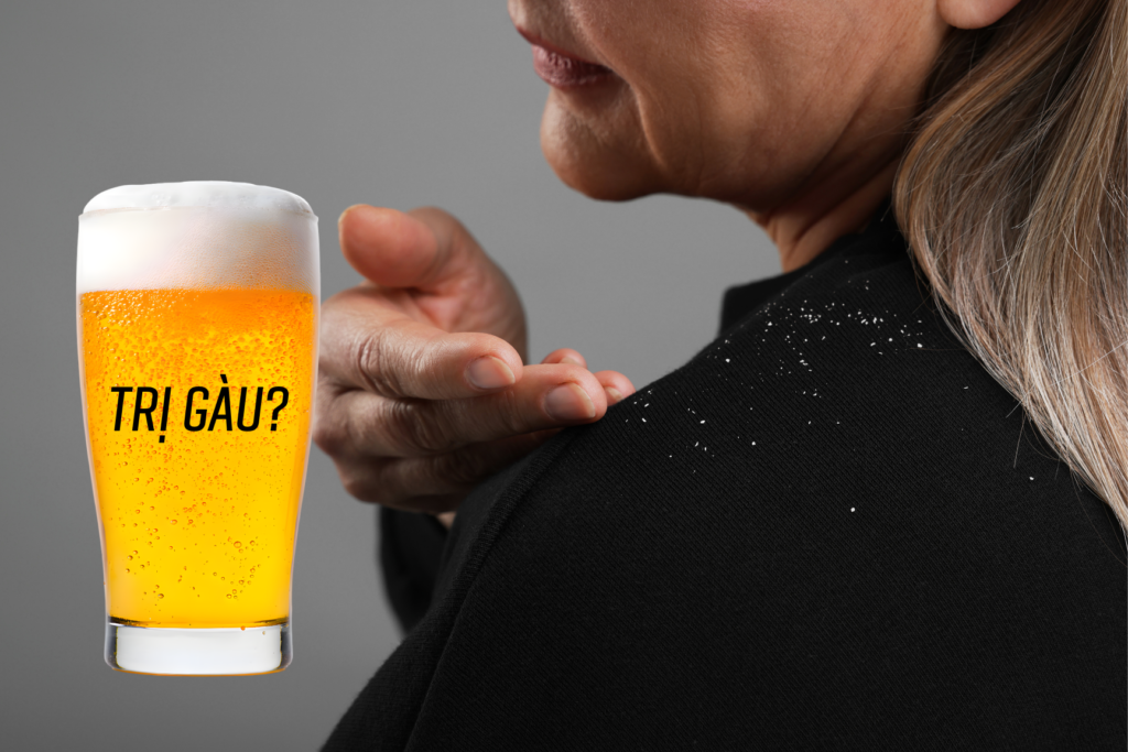 Cách gội đầu bằng bia trị gàu