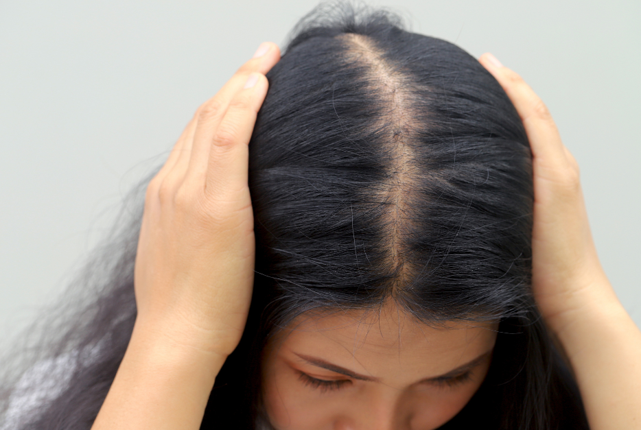 Nếu tình trạng rụng tóc kéo dài nên đi khám kịp thời
