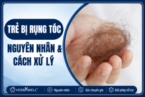 Trẻ bị rụng tóc