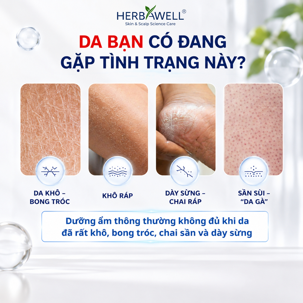 Kem dưỡng ẩm TT Urea 20%